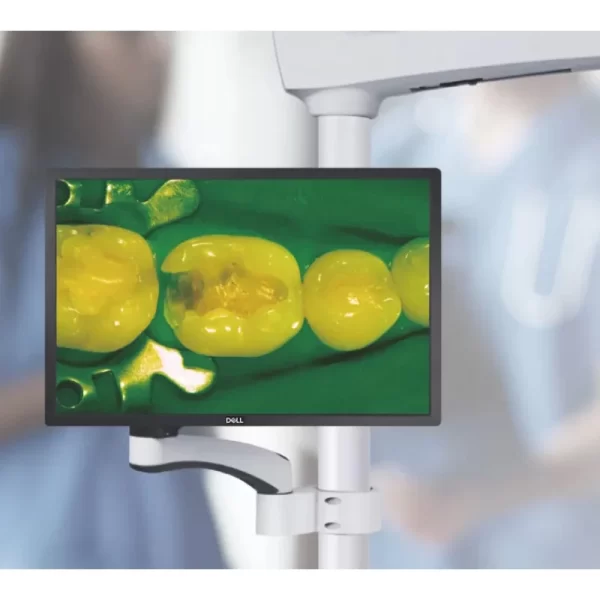 Microscop endodontic C-Clear 2 Coxo cu camera Sony 4K inclusa - imagine 4