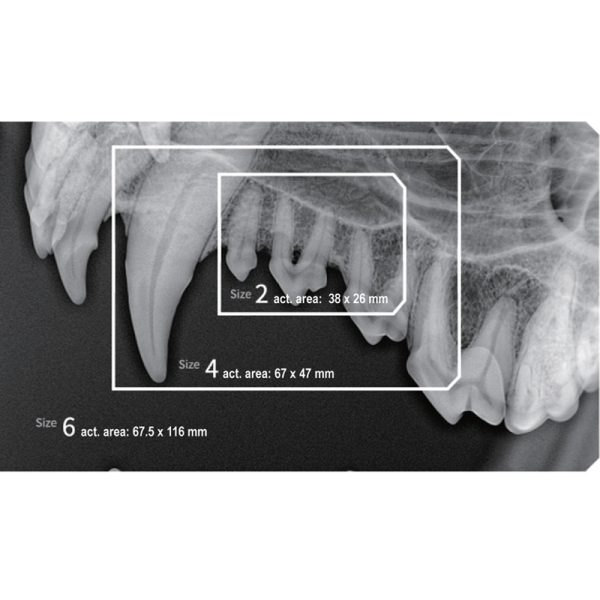 Senzor intraoral radiologic Digisens HD - imagine 9
