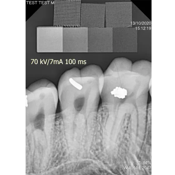 Senzor intraoral radiologic Digisens HD - imagine 6
