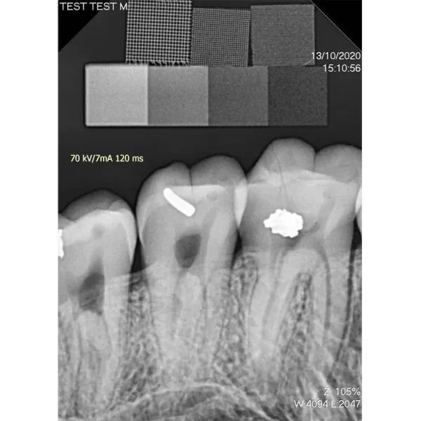 Senzor intraoral radiologic Digisens HD - imagine 5