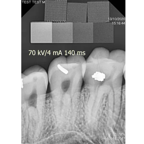Senzor intraoral radiologic Digisens HD - imagine 4