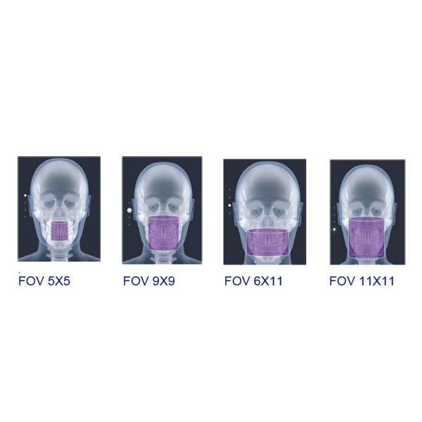 Aparat de radiologie dentară OPERA 3D - imagine 5