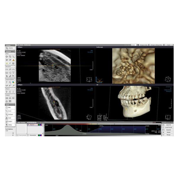 Aparat de radiologie dentară OPERA 3D - imagine 4