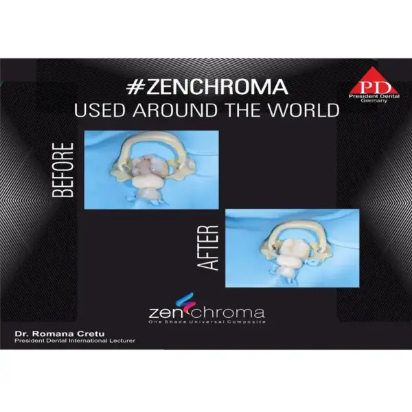Zenchroma compozit universal Refill 4g President - imagine 4