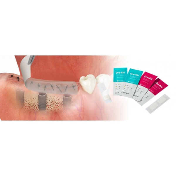 Ora-Aid pansament intraoral atasabil 20 bucati/cutie - imagine 2