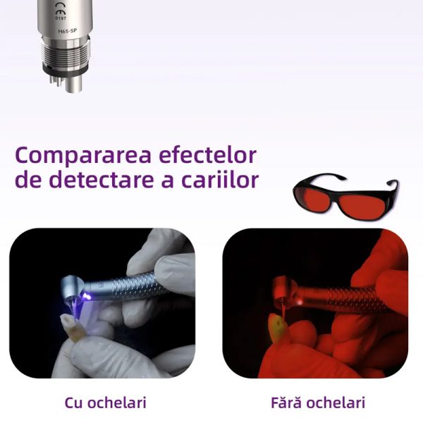 Turbina dentara CX207-F H65-TP M4 Led cu detectie carie Coxo - imagine 2